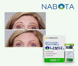 NABOTA®: South Korean Precision for Natural Facial Smoothing